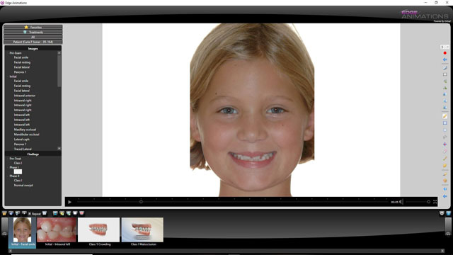 Customizeable pediatric dental and orthodontic animations