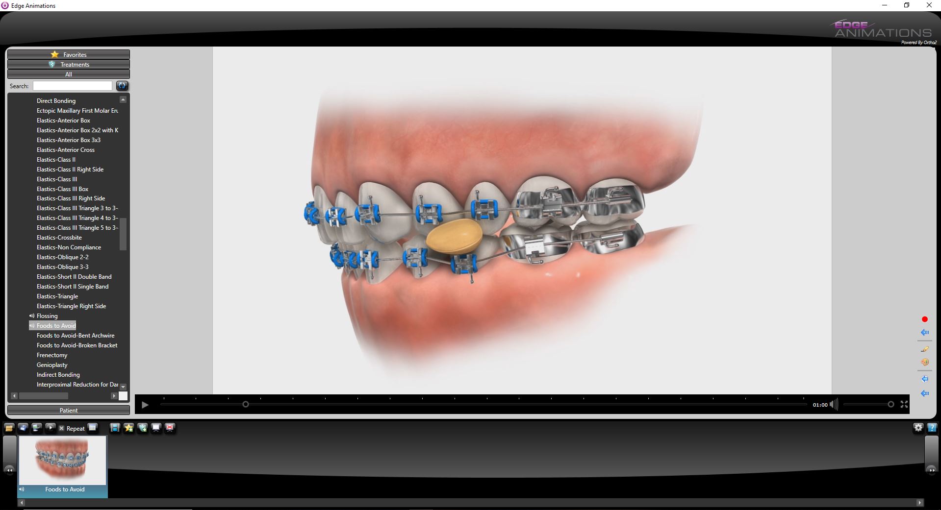 Educational videos for your pediatric dental and orthodontic patients.